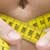 Anorexia Nervosa
